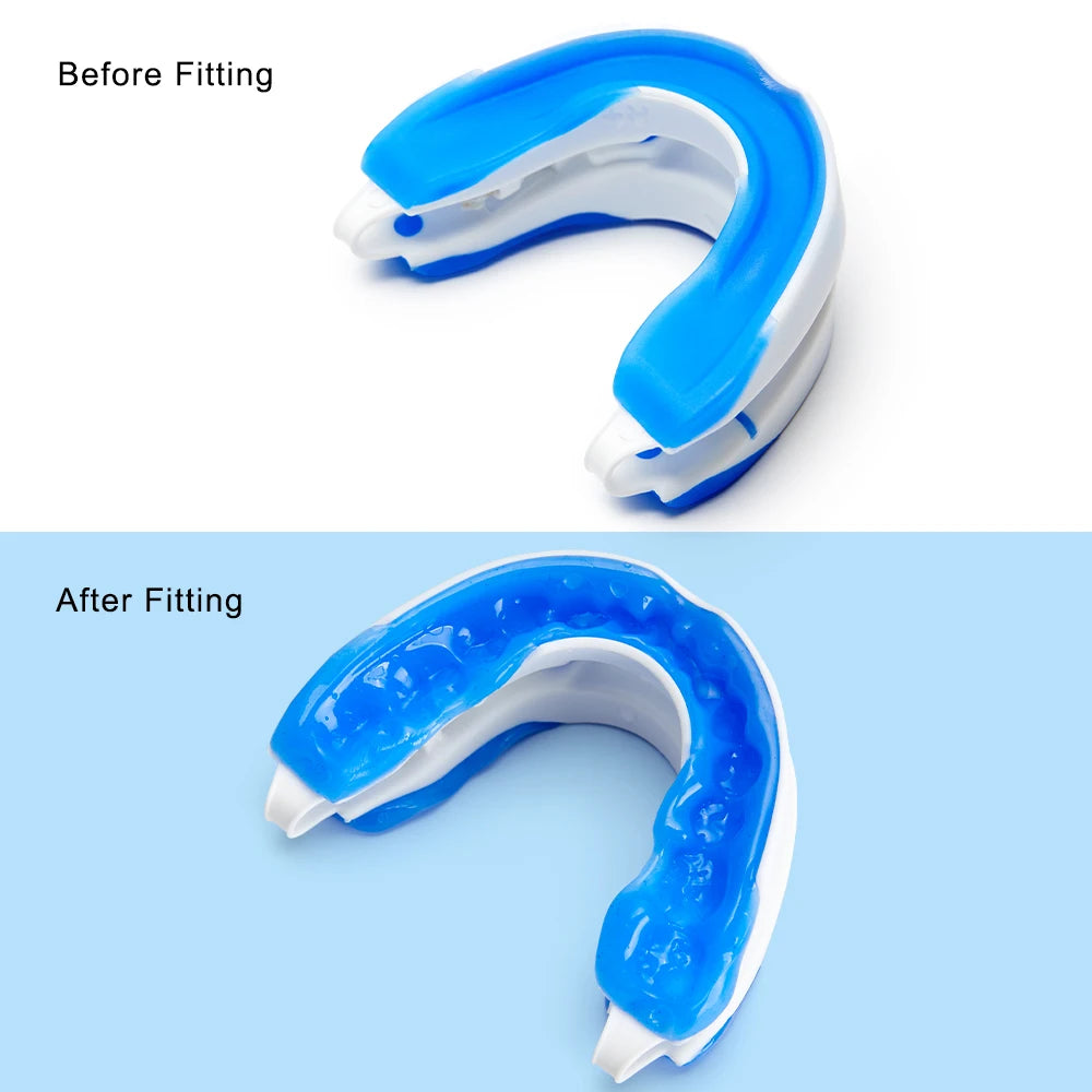 Silicone Anti-Snore Mouth Guard – Sleep & Apnea Aid