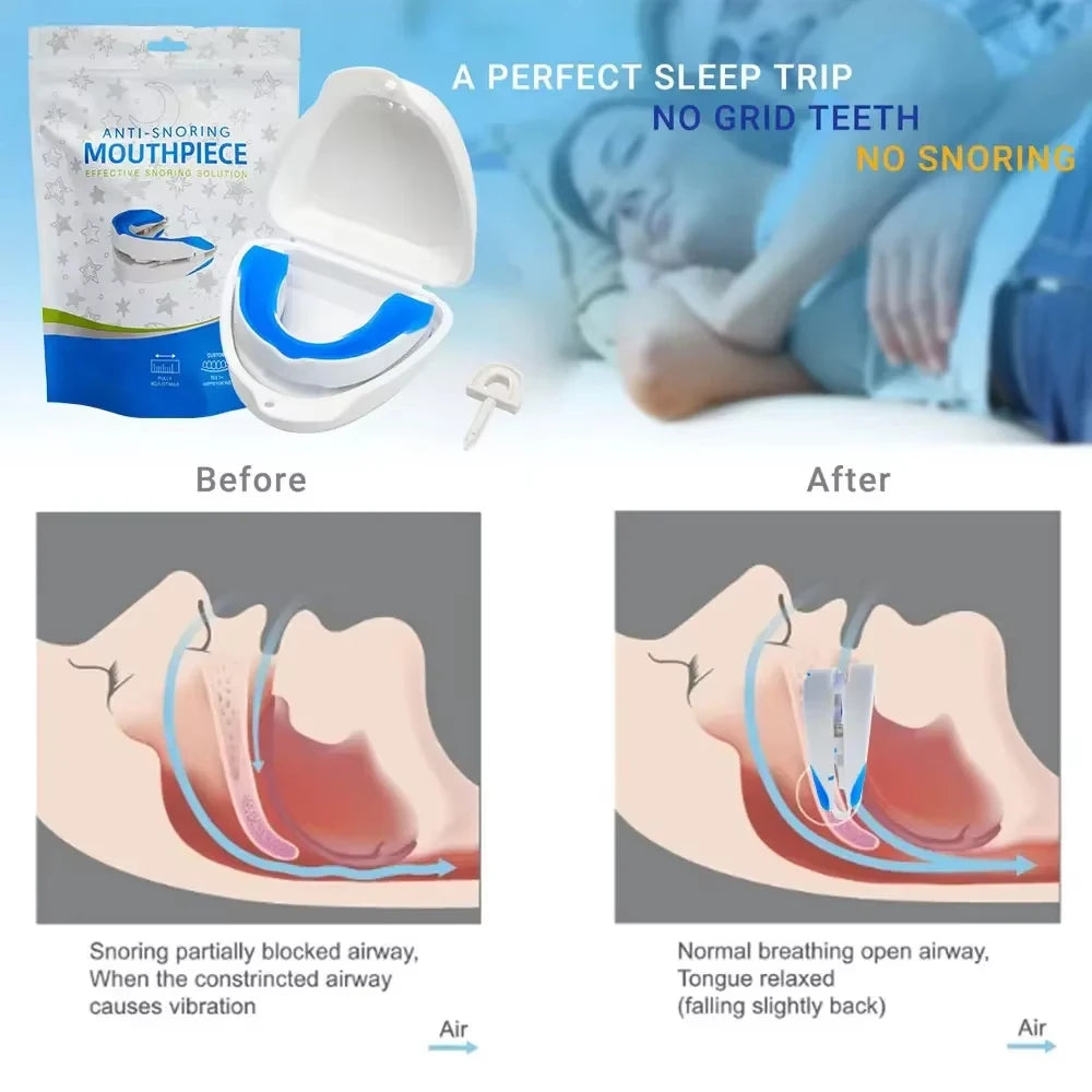 Silicone Anti-Snore Mouth Guard – Sleep & Apnea Aid